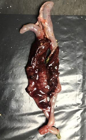 Blood in ceaca