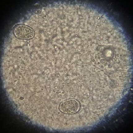 Oocysts under the microscope