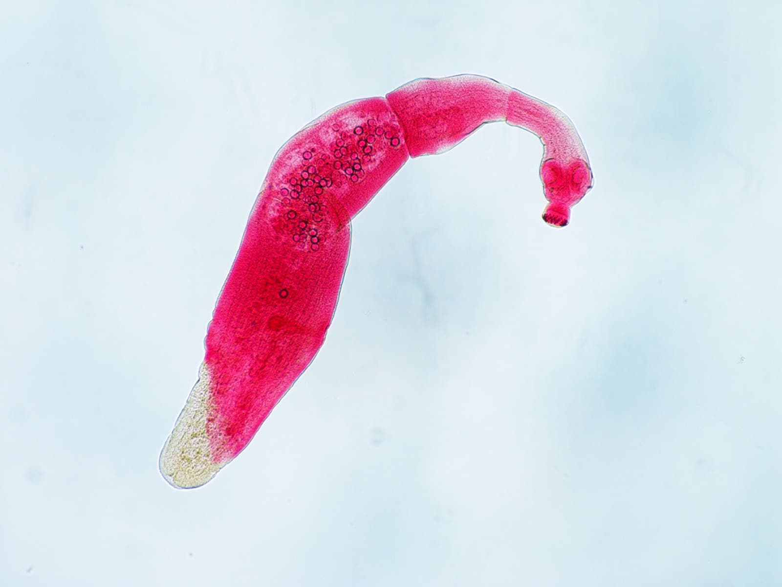 Tapeworm