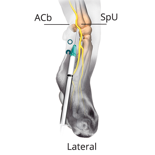 Nocita administration needle showing insertion point on an illustrated lateral cat limb