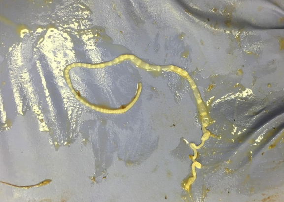Large tapeworms