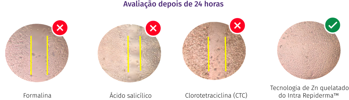 Avaliação depois de 24 horas - Repiderma leite