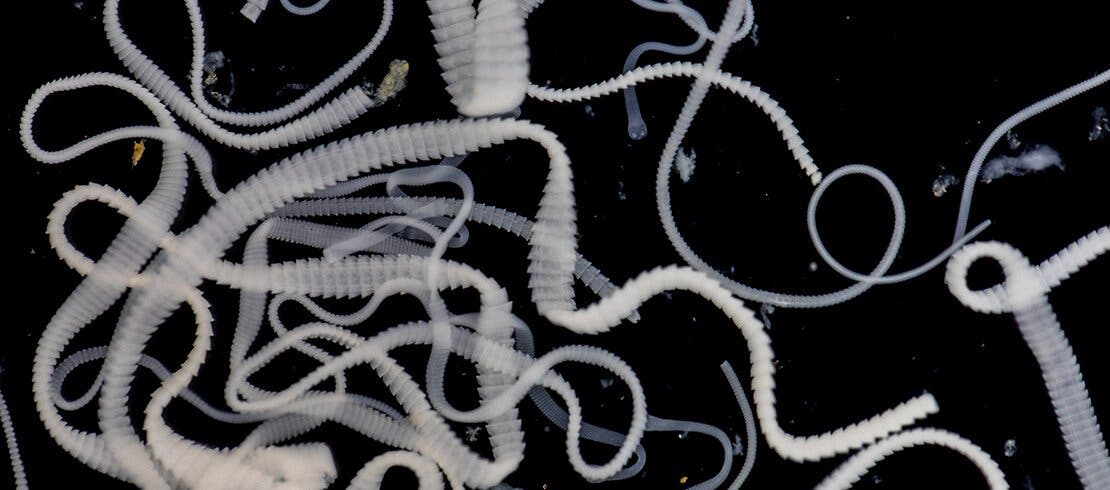  Tapeworms under a microscope. 