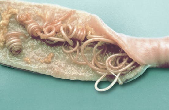 Roundworms in the intestinal tract