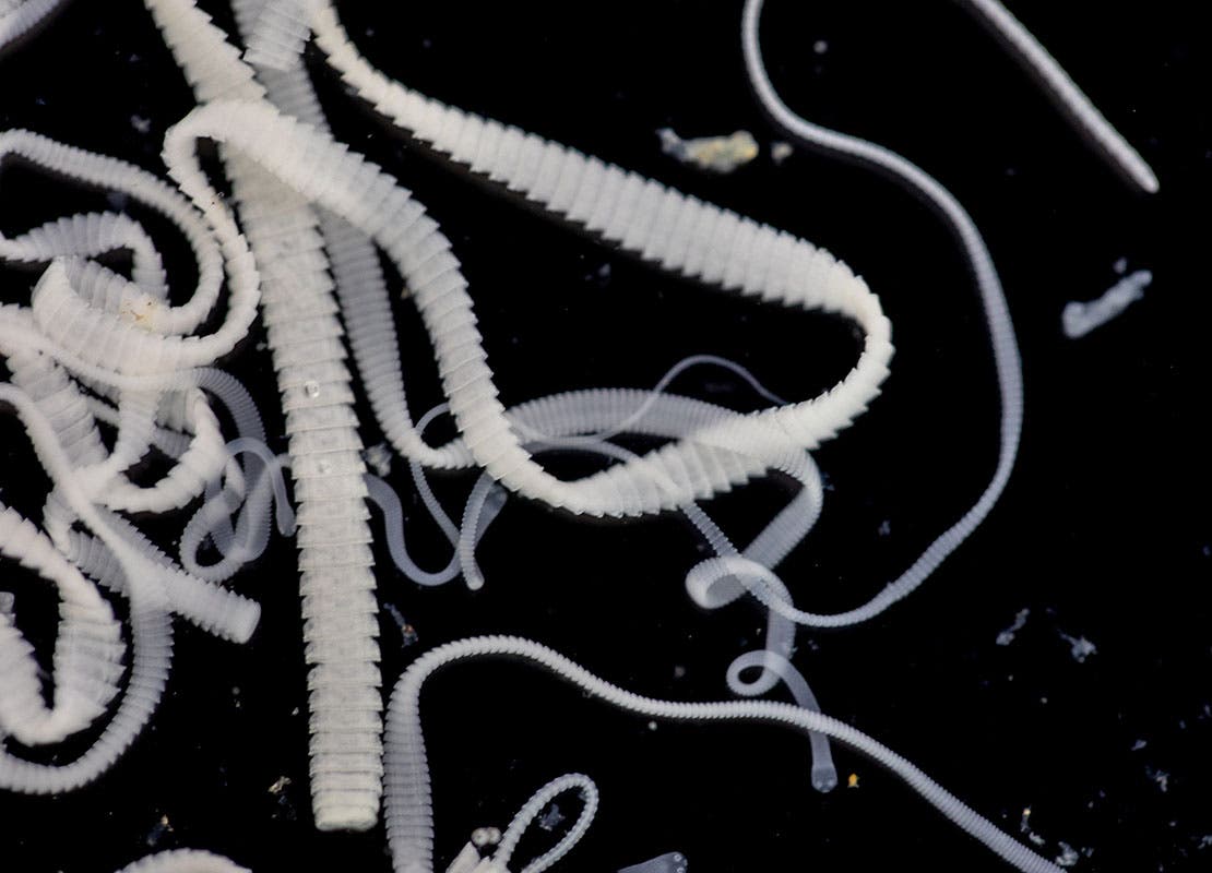 Photo de ténias au microscope