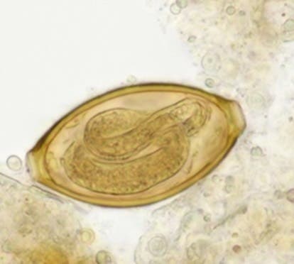 Whipworm egg under a microscope