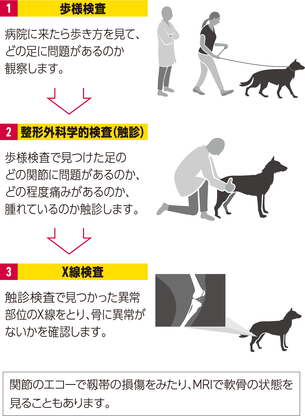 OAと診断