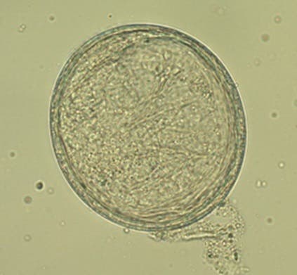 Roundworm egg under a microscope