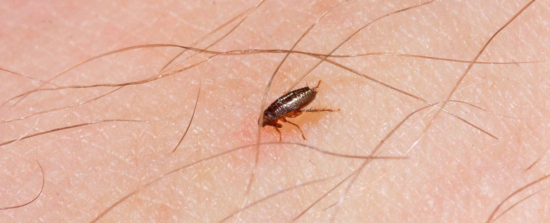 Close up of fleas on human skin