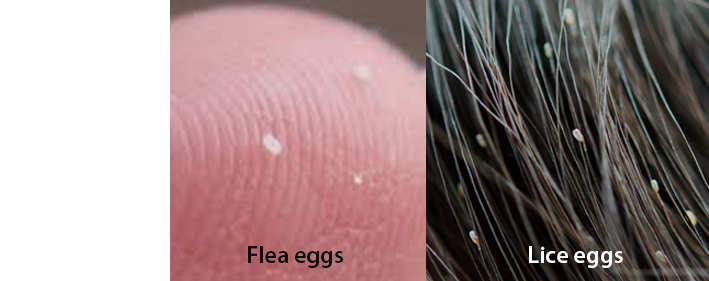 Flea eggs vs lice eggs