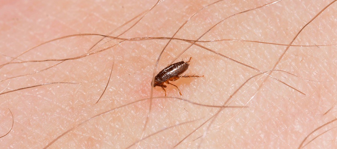 An image of a flea on human skin
