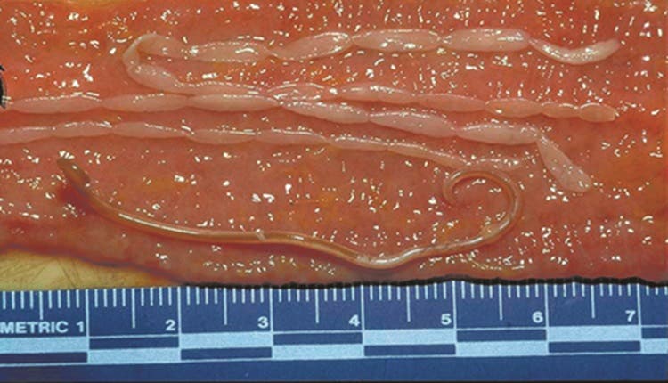 Flea tapeworm