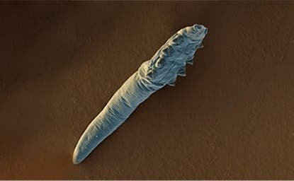 Demodectic mange