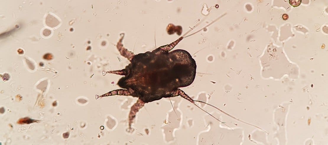 An ear mite under a microscope.