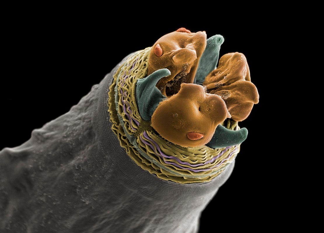 Cabeza de lombriz intestinal