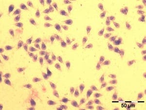 Giardia microscopic cysts