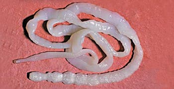Close-up of a segmented tapeworm.