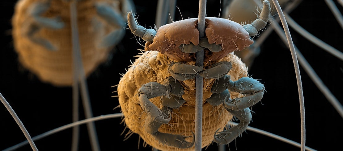 A lice wrapped around a strand of pet’s fur.