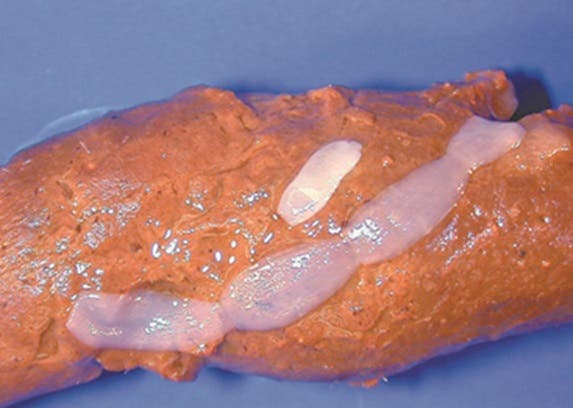 Flea tapeworm